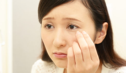 【ニキビがピーリングで悪化】自宅でのピーリングは白ニキビにおすすめ！